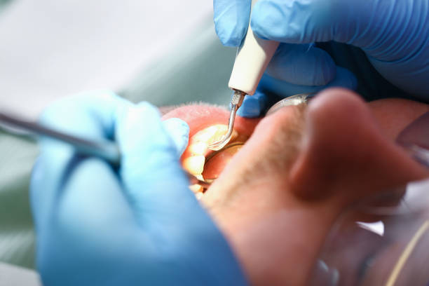 Best Urgent Dental Care for Toothaches in Royal Palm Estates, FL