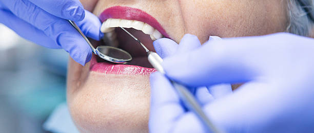 Best Emergency Cosmetic Dentistry (e.g., broken veneers) in Royal Palm Estates, FL